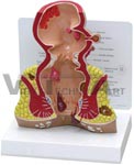 Rectum Anatomy Model - Shows various diseases of the rectum